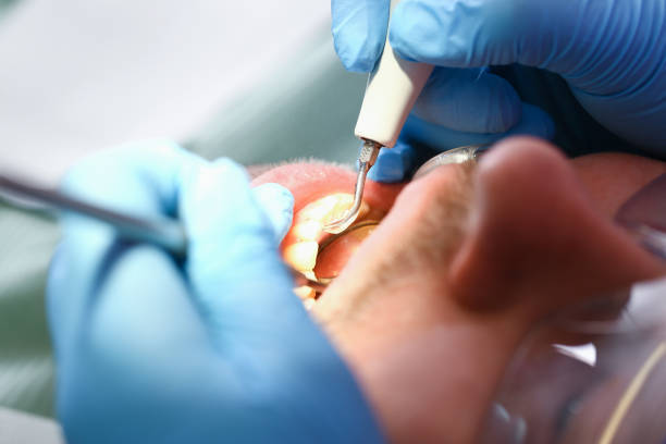 Best Emergency Broken Tooth Repair in Stroud, OK